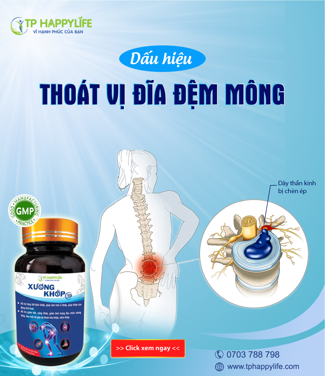 Dấu hiệu thoát vị đĩa đệm mông điển hình