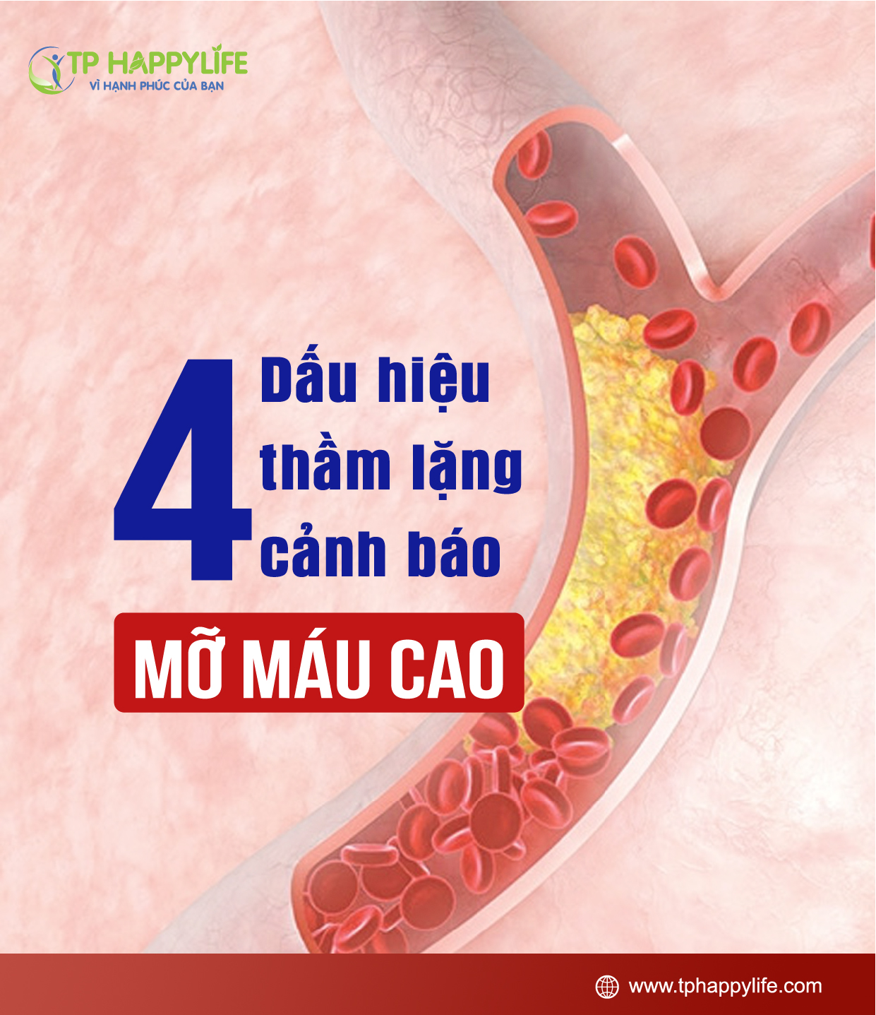 4 dấu hiệu thầm lặng cảnh báo mỡ máu cao.