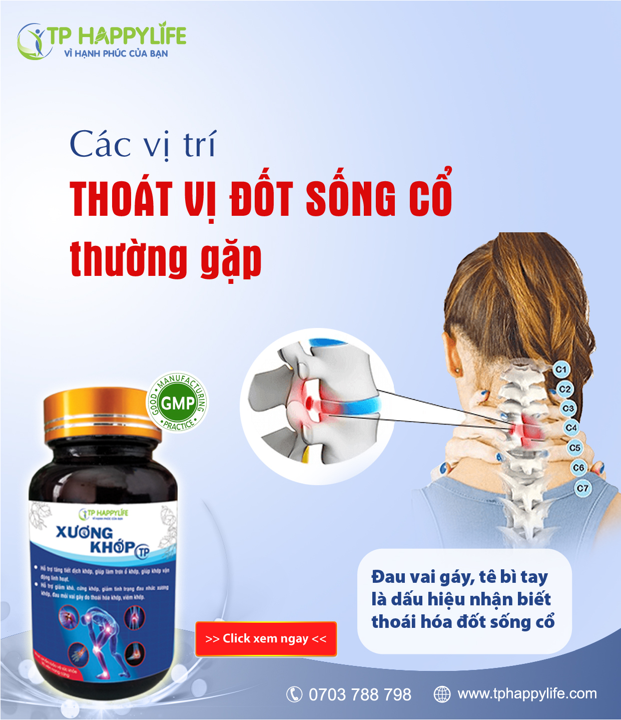 Các vị trí thoát vị đốt sống cổ thường gặp