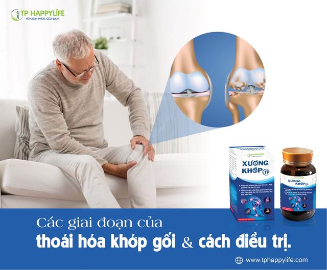 Các giai đoạn của thoái hóa khớp gối và cách điều trị.