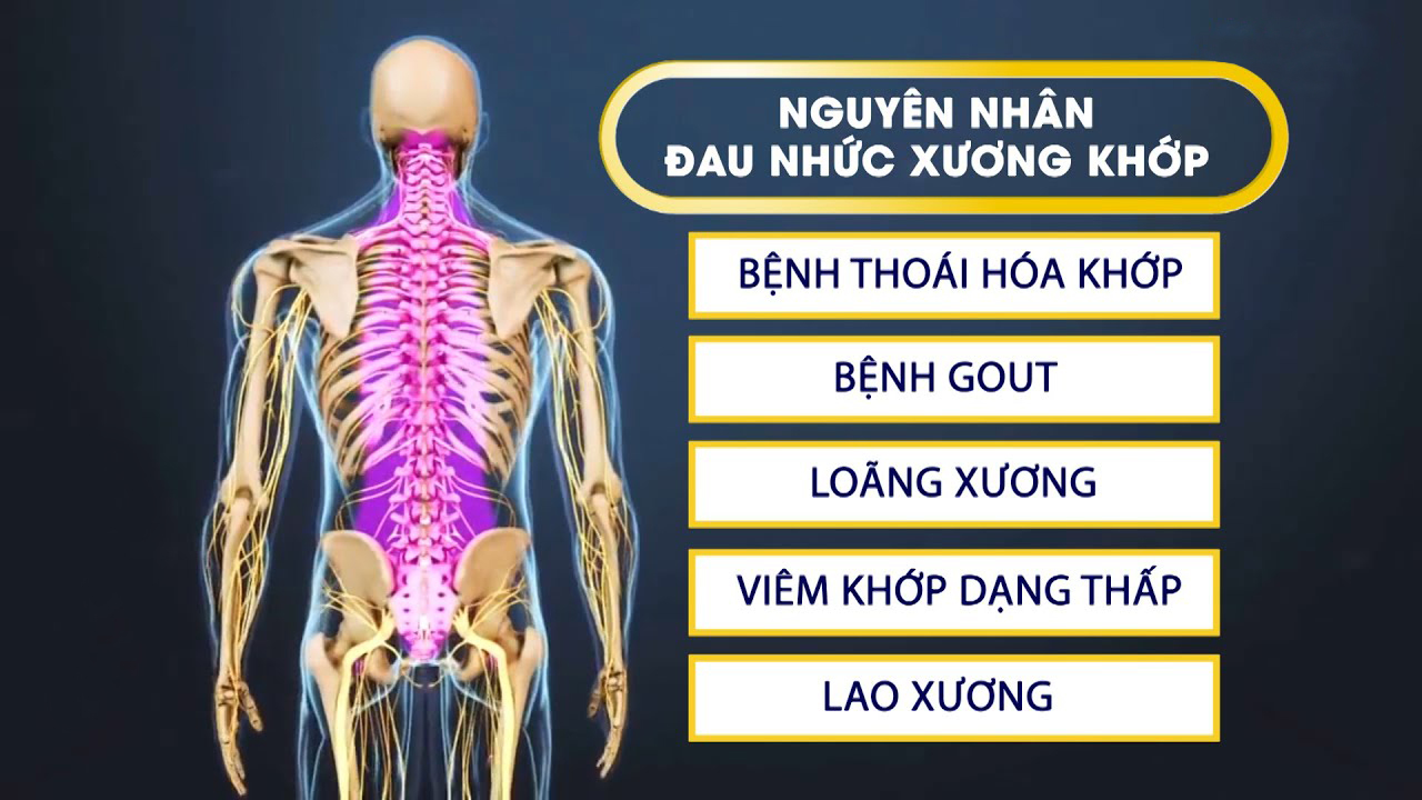 Triệu chứng đau nhức xương khớp đang “hành hạ” bạn mỗi ngày.