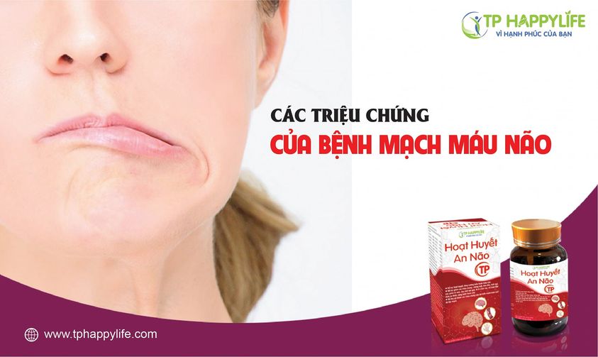 Các triệu chứng của bệnh mạch máu não.