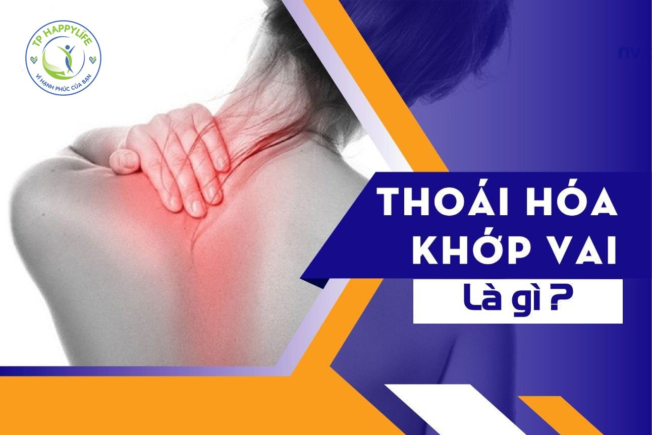 Nhận diện dấu hiệu của thoái hóa khớp vai