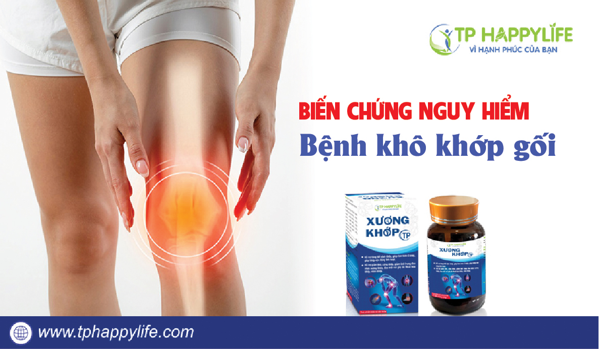 Bị khô khớp gối có nguy hiểm không?