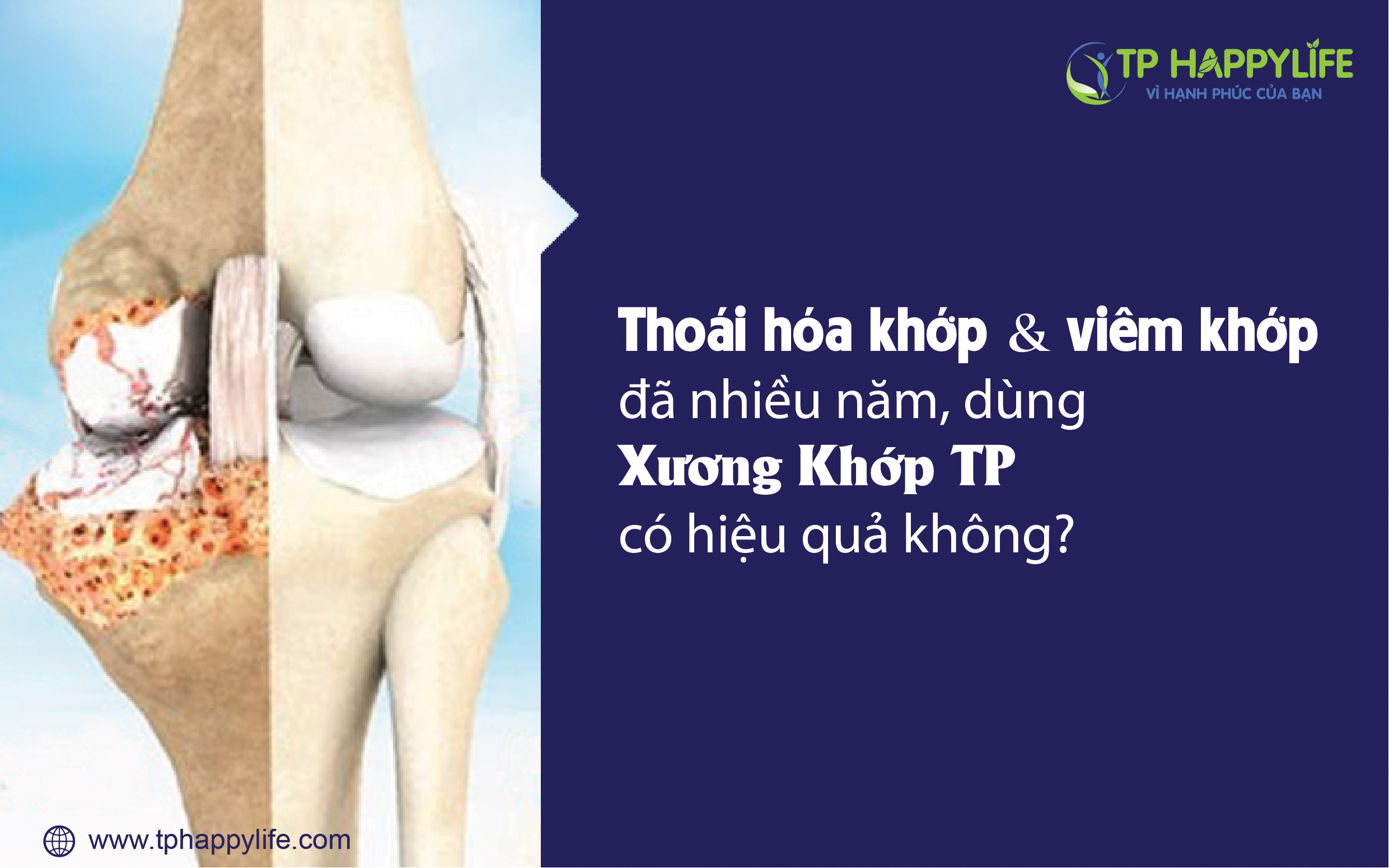 Thoái hóa khớp và viêm khớp đã nhiều năm, dùng Xương Khớp TP có hiệu quả không?